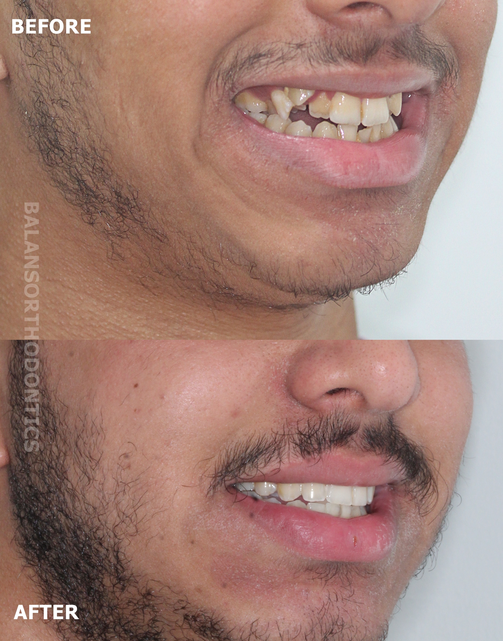 Treatment 10