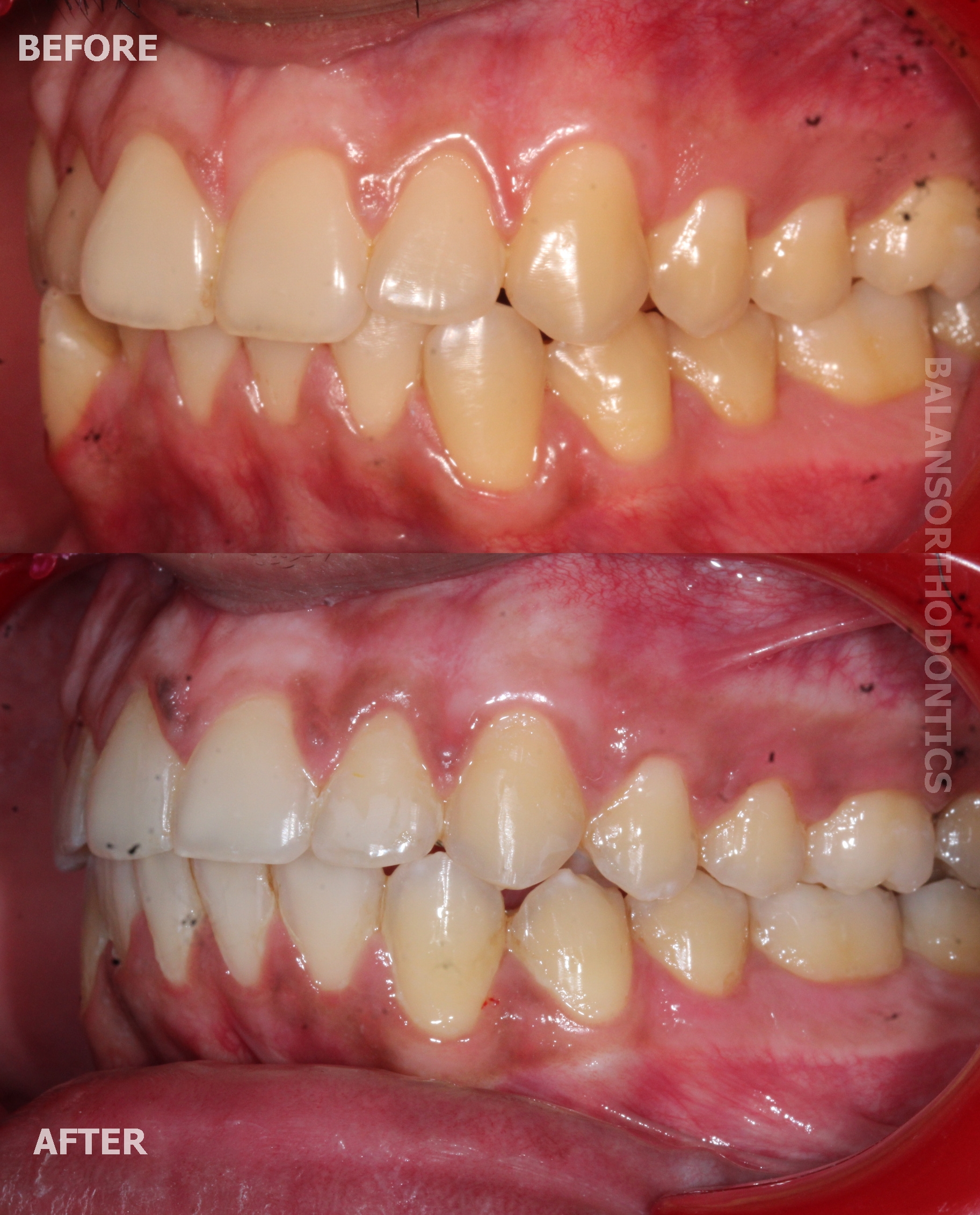 Treatment 16