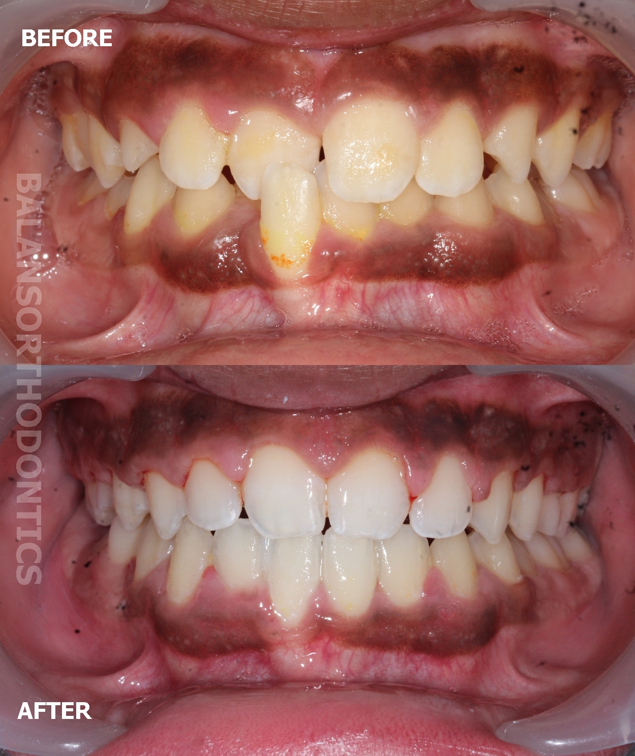 Treatment 19
