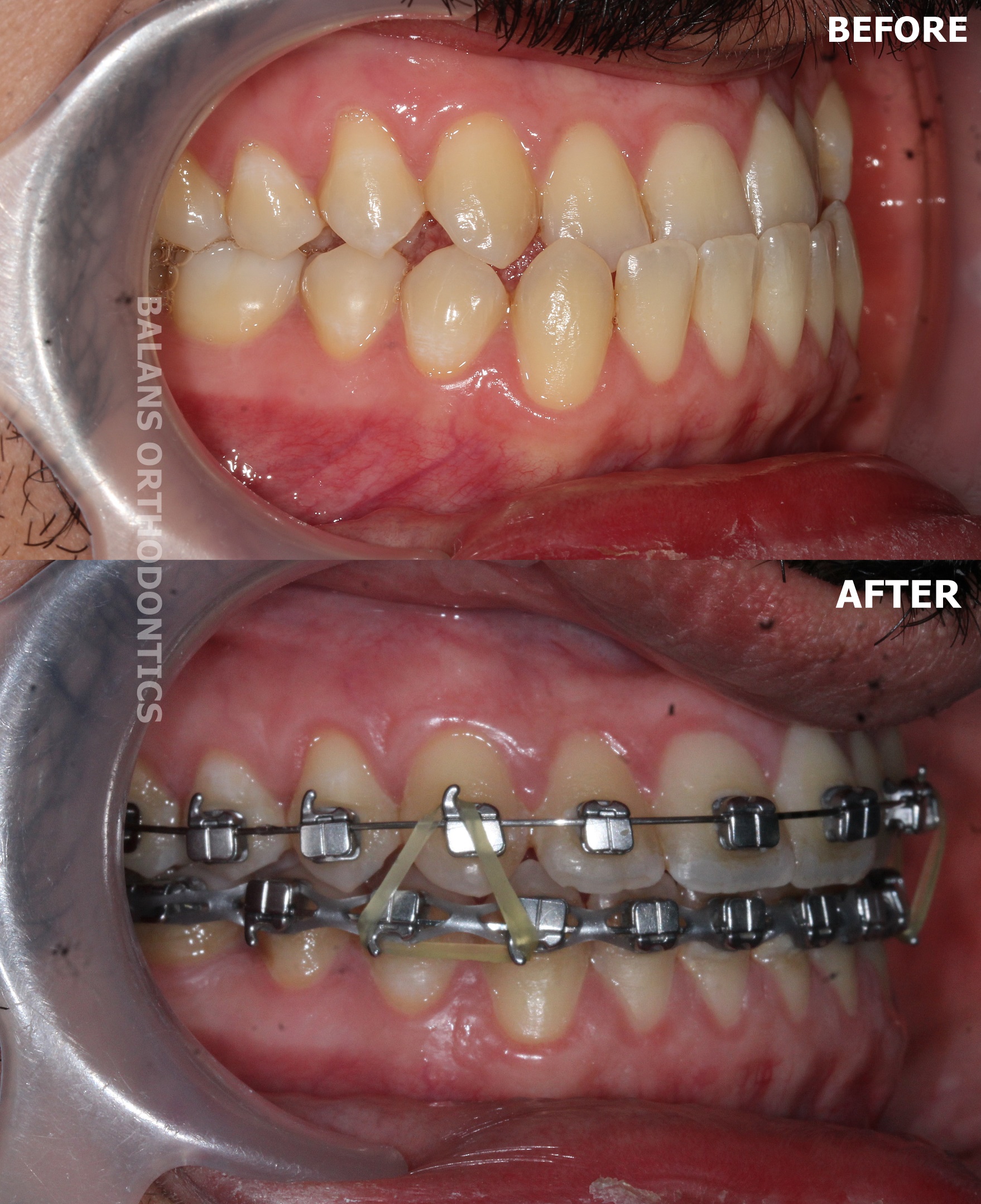 Treatment 20