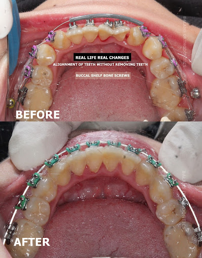 Treatment 5