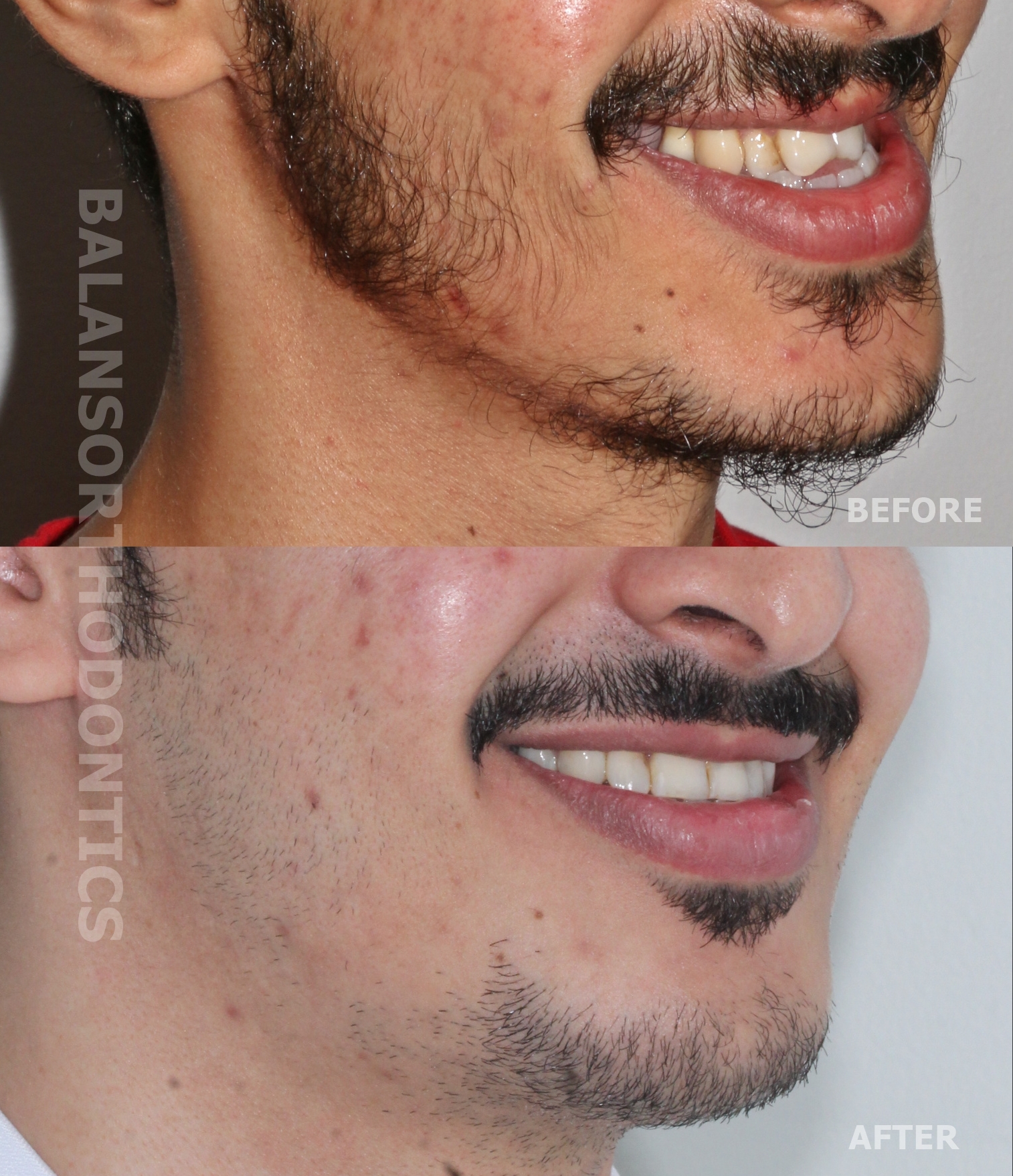 Treatment 7